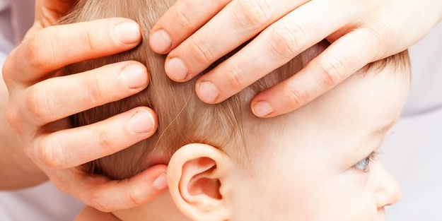 Kafa şekil bozukluğu; bebekleri ne bekliyor? Kaç yaşında oluyor?