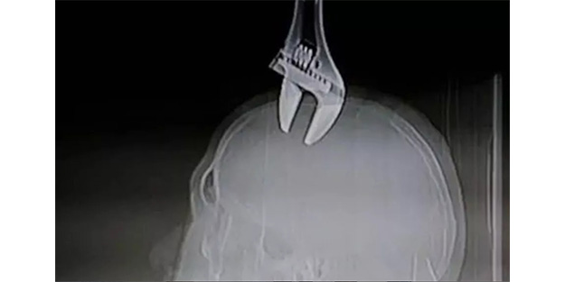 Kafasına kurbağacık saplandı!