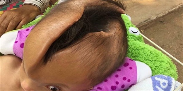 Kafasındaki kocaman yarıkla dünyaya geldi