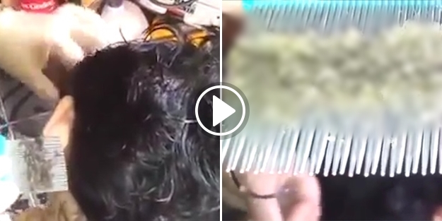 Kafasından çıkan bitler görenleri şoke etti