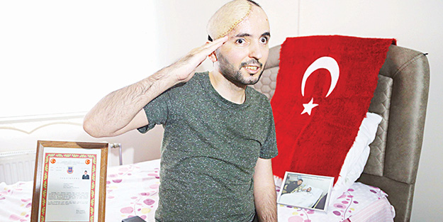 Kafatasının yarısını kaybetse de vatan aşkını kaybetmedi