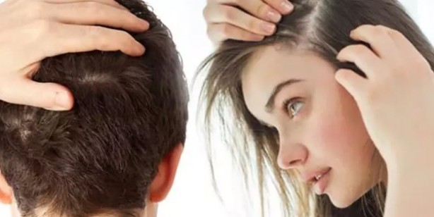 Kahveyi ıslatıp saçınıza sürerseniz bakın ne oluyor! Saç dökülmesini durdurun: Saçınızdan, sakalınızdan saç fışkıracak