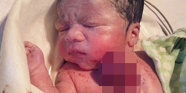 Kalbi dışarıda doğdu!