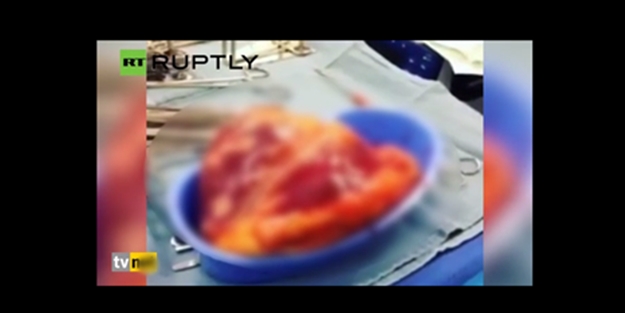 Kalbi tam 25 dakika dışarıda attı!