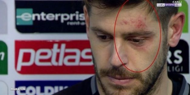 Kaleci Fabri canlı yayına böyle çıktı!