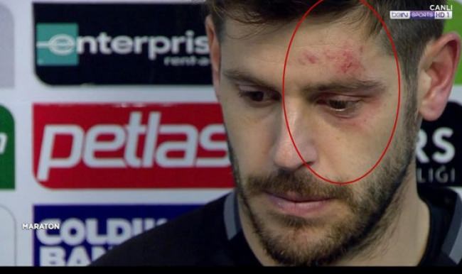 Kaleci Fabri canlı yayına böyle katıldı