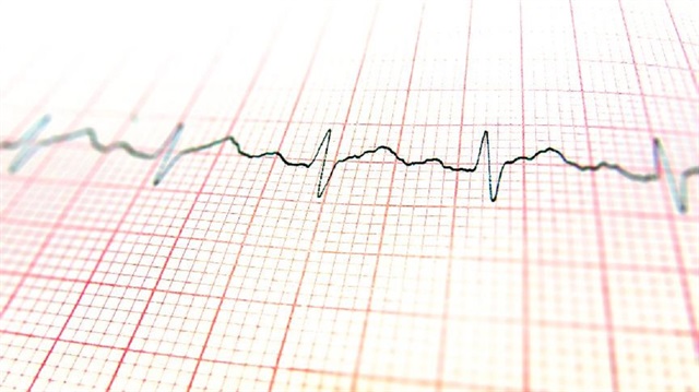 Kalp atış hızını kameralar ölçecek