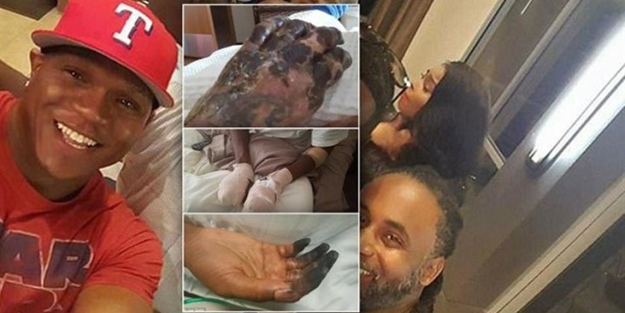 Halsizlik şikayetiyle acile gitti, parmaklarını kestiler