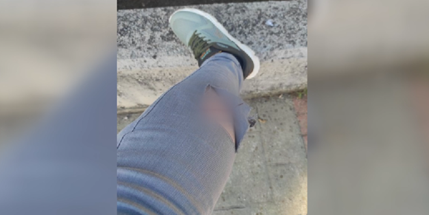 Kampüs mü köpek çiftliği mi? Saldırıya uğrayan öğrencilerden yardım çağrısı!