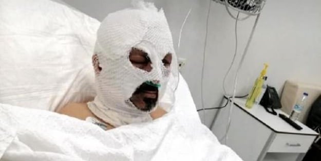 Kan donduran olay! Tiner döküp diri diri yaktı