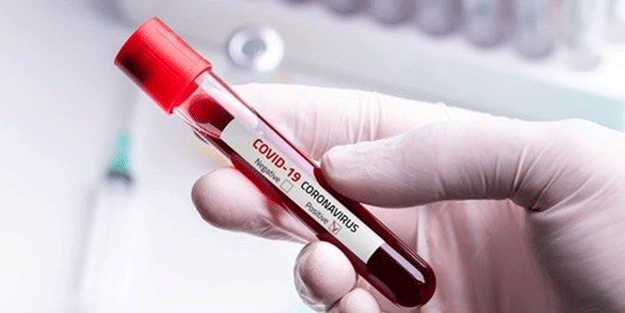 İşte koronavirüse karşı en avantajlı kan grubu