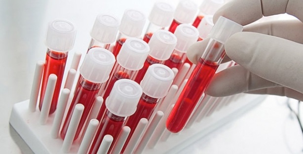 Kan grubu A RH olanlar bunları yerken aman dikkat! Hasta edebilir