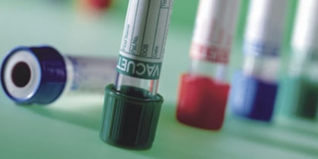 Bu kan grubunda olanlar dikkat!