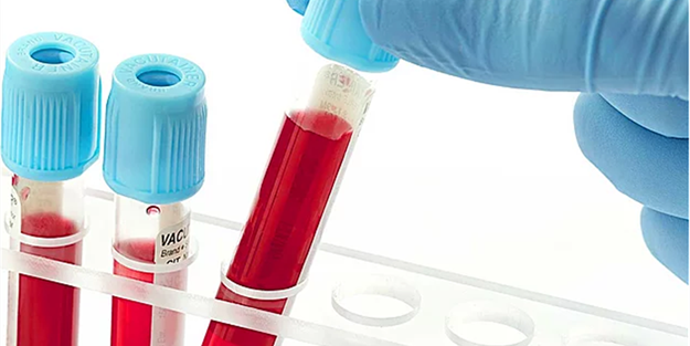 Kan grubuna göre karakter analizi