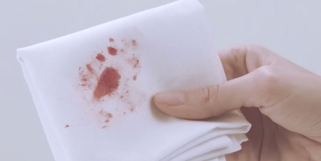 Kan lekesinden nasıl kurtulabiliriz?