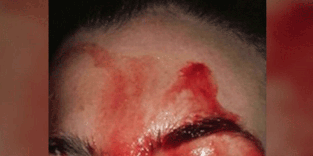 Kan terleyen genç kadın hastaneye kaldırıldı