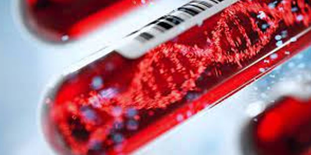 Kan testiyle kanseri tespit ettiler