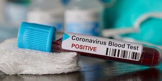 Kanada’da koronavirüs bilançosu arttı