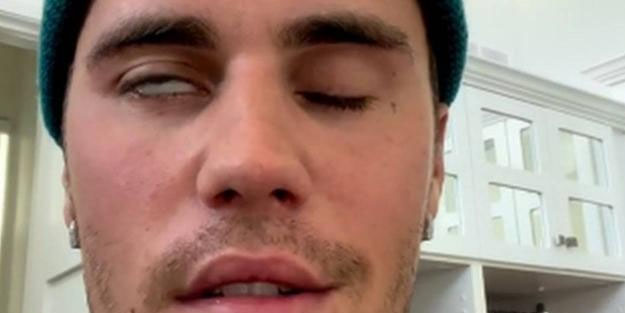 Kanadalı şarkıcı Justin Bieber yüz felci geçirdi