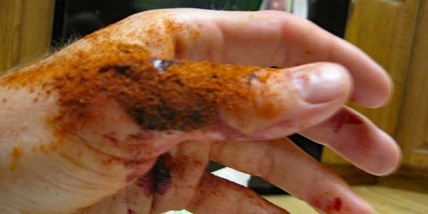 Kanamayı bu baharatla 10 saniyede durdurun