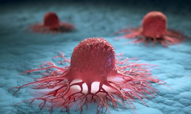 Kanser ölümcül olmaktan çıkıyor mu? Proje olumlu sonuç verdi