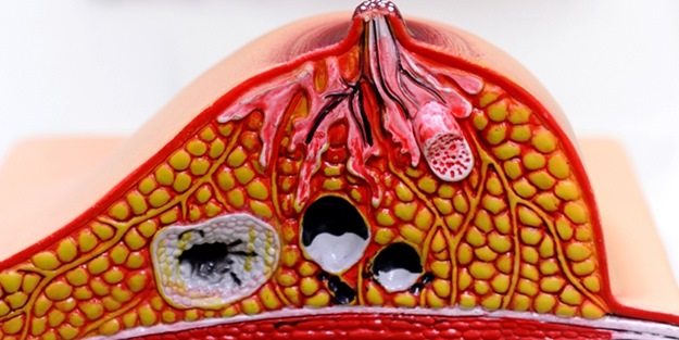 Kanser hastaları için müthiş haber