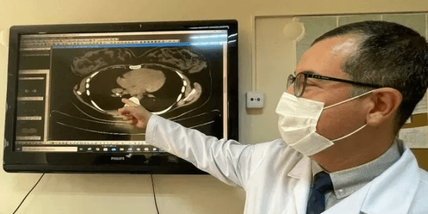 Kanser sanıldı, soluk borusundan badem zarı çıktı