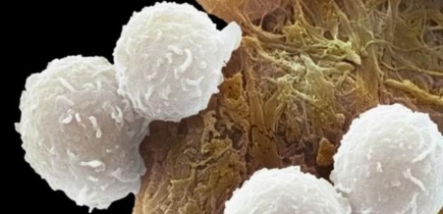 Kanser tedavisinde çok önemli gelişme