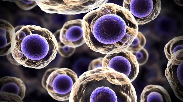 Kanser tespiti kolaylaşacak