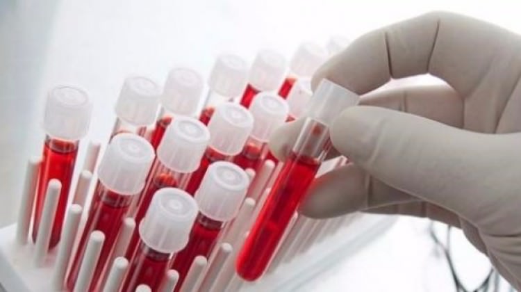 Kanserde erken tanı hayat kurtarıyor