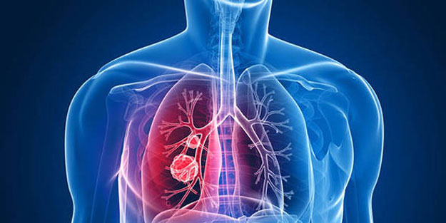 Kanserde yeni umut… Farelerde tümörü tamamen yok etti