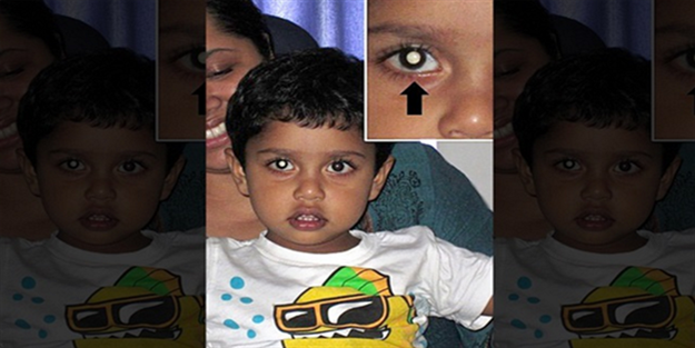 Kanseri fotoğrafla teşhis etti!