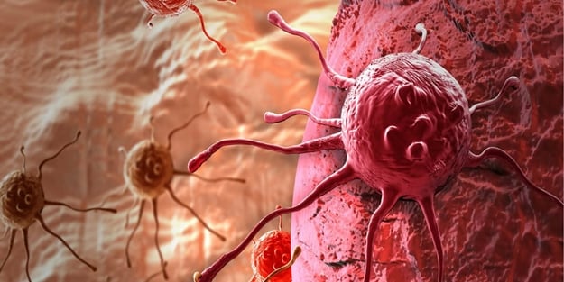 Kanserin şakaya gelmeyecek 7 belirtisine dikkat!