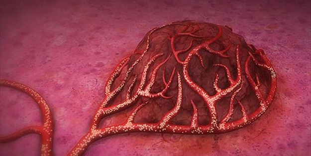 Kanserin sanılandan çok daha eskiye dayandığı ortaya çıktı