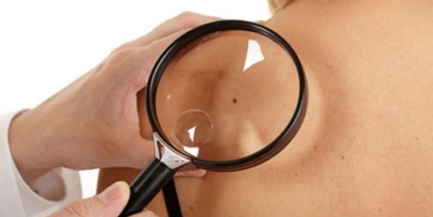 Kanserli ben nasıl anlaşılabilir?