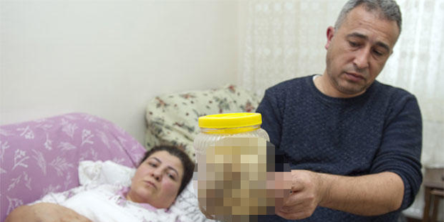 Yanlış tanı koydular, karnından çıkanlar şoke etti! Bir kavanoz dolusu...