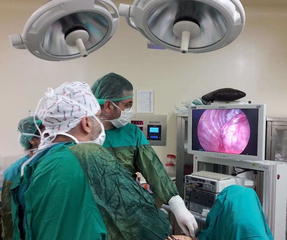 Kapalı yöntem akciğer kanseri ameliyatları 