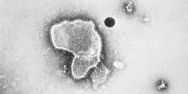 Kapasiteleri doldu! Almanya'da felaket