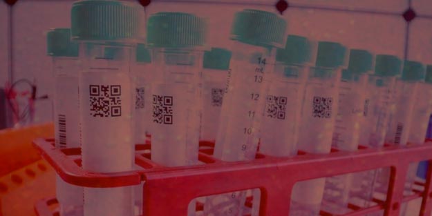 Kapsamlı corona virüs tanı testleri Koronavirüs (Corona virüs) testleri nedir, nerede yapılır?