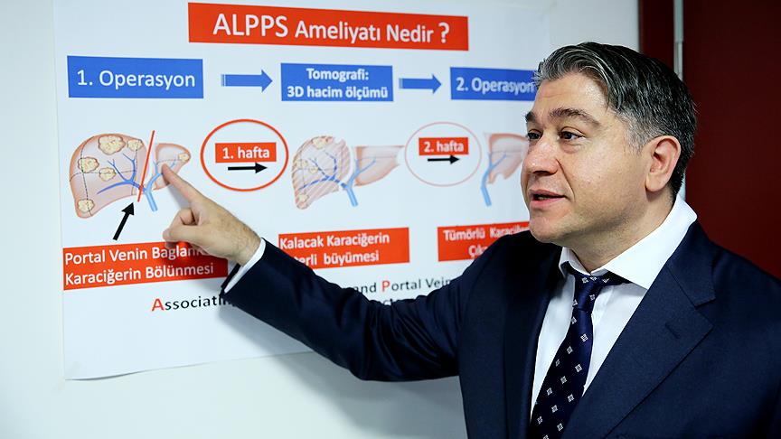 Karaciğer kanseri hastalarına yeni ümit