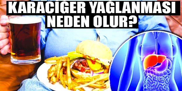 Karaciğer yağlanması nedir? Karaciğer yağlanması neden olur, belirtileri nedir?