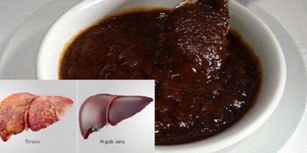 Karaciğer yağlanmasına doğal kür