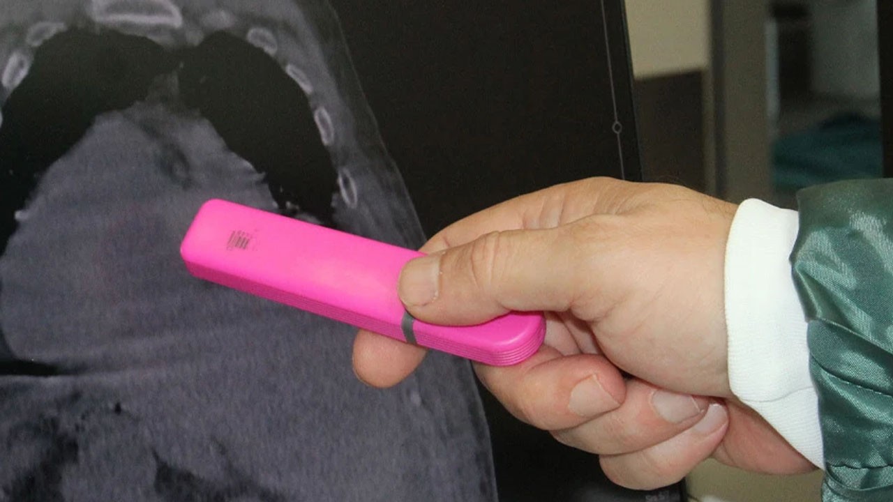 Karadeniz'de yeni tanı! Prof. Dr. Ahmet Tüm Türkiye'yi şaşırttı: 'Karadeniz Sendromu'