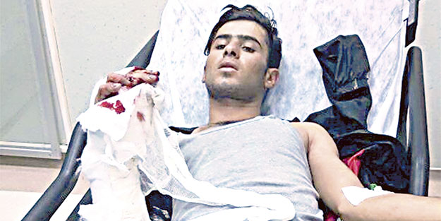 Karakola atacağı bomba elinde patladı