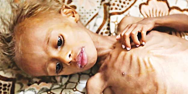 Kardeş Eli'nden Yemen'e acil yardım