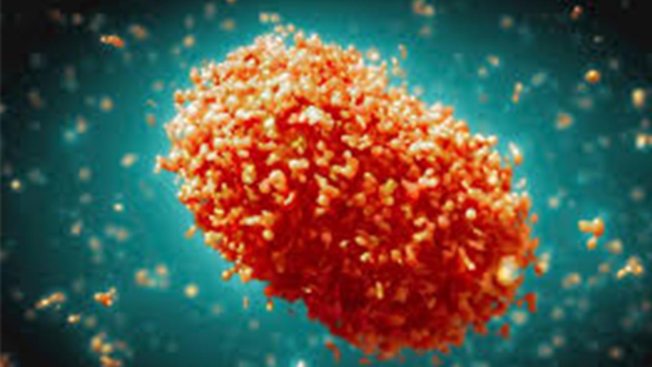 Kardeş ülkede ilk maymun çiçeği vakası