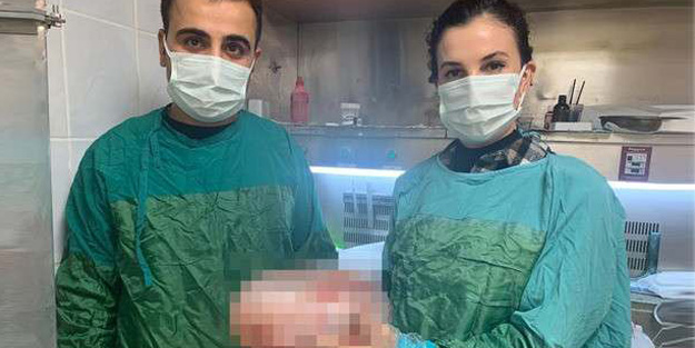 Karın ağrısı şikayetiyle gitti karnından çıkan şoke etti!