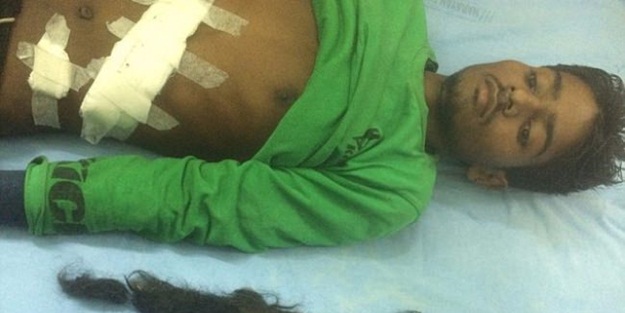 Karın ağrısıyla gitti, bakın ne çıktı!