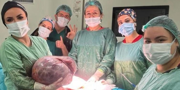 Karın şişkinliği nedeniyle apar topar şikayetiyle gitti: İlginç olay ortaya çıktı! Bakın ne oldu?