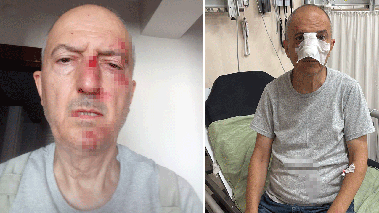 Karısı evi sattı, evden atıldı, kayınbiraderi burnunu kırdı!